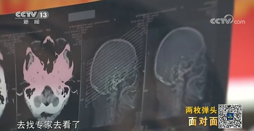 
天津肿瘤医院黄牛代挂号电话票贩子号贩子网上预约挂号,住院检查加快,致敬！95岁老兵就医时发现颈部有颗子弹
