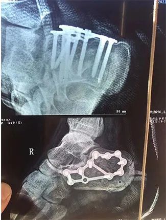 
空军特色医学中心黄牛代挂号电话票贩子号贩子网上预约挂号,住院检查加快,“00后”请出列！