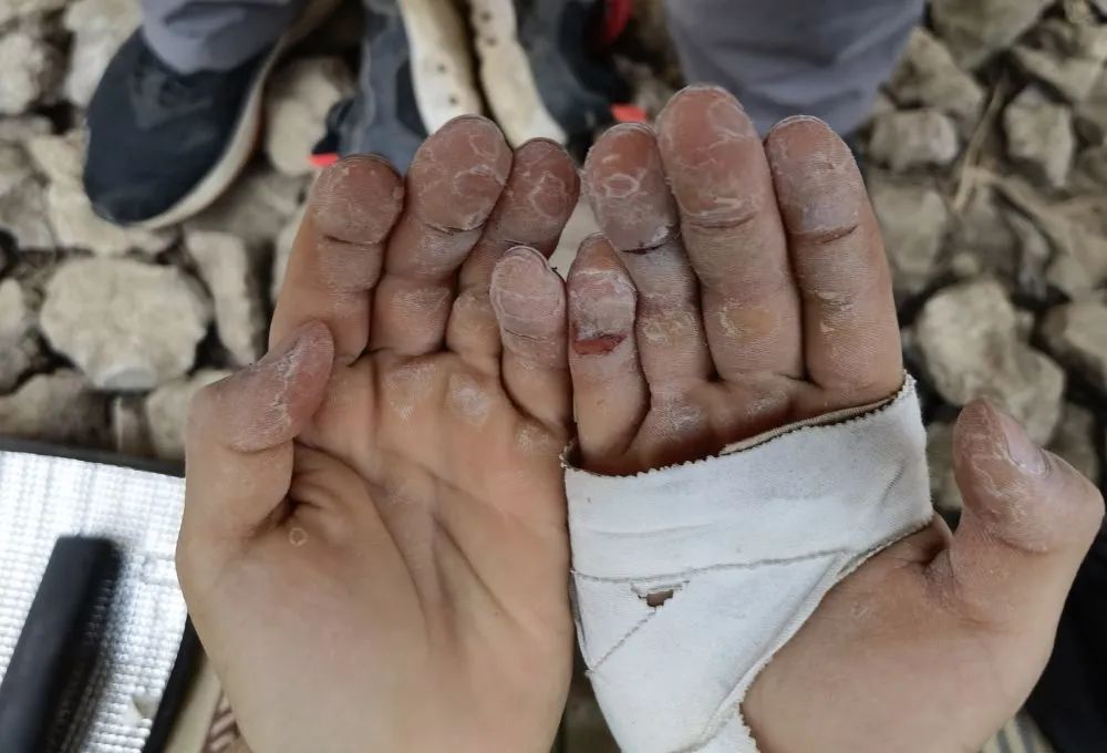 
北京肿瘤医院黄牛代挂号电话票贩子号贩子网上预约挂号,住院检查加快,打破纪录，她才8岁！