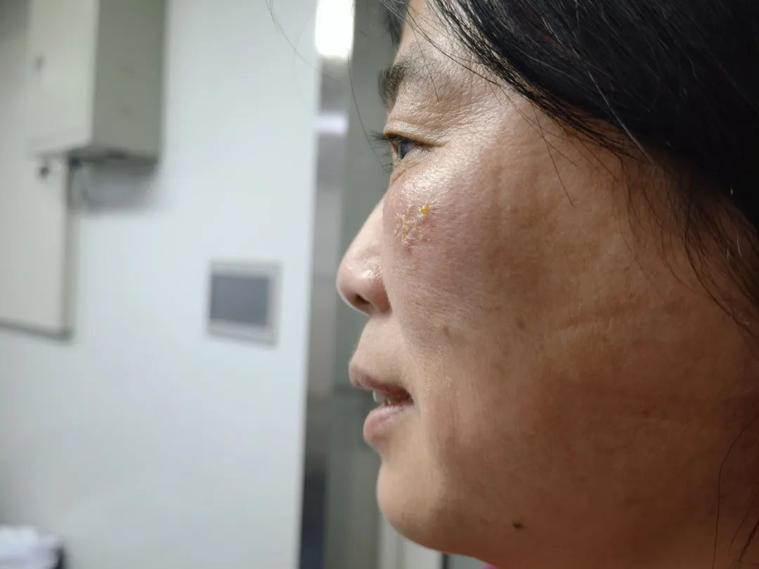 
首都医科院整形外科医院黄牛代挂号电话票贩子号贩子网上预约挂号,住院检查加快,战“疫”特写 ｜感恩那些奔赴战“疫”的你