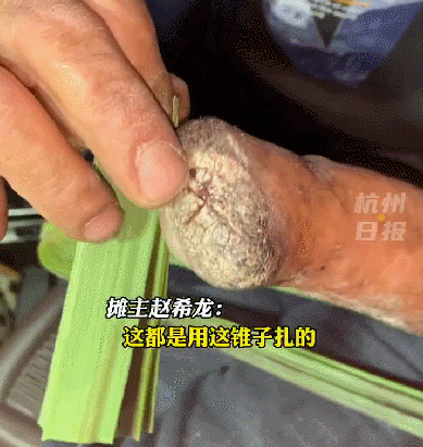 
广州中医药大学一附医院黄牛代挂号电话票贩子号贩子网上预约挂号,住院检查加快,这个摊位占“C位”！看到他的手，网友绷不住了...