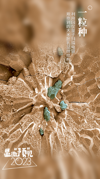 
杭州中医院黄牛代挂号电话票贩子号贩子网上预约挂号,住院检查加快,显影动海报｜显微视角“预”见2023