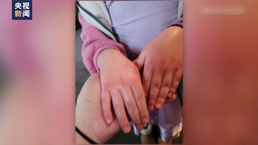 
北京儿童医院黄牛代挂号电话票贩子号贩子网上预约挂号,住院检查加快,美国俄亥俄州居民担心环境污染 反复追问真相无果