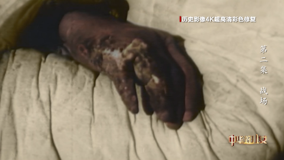 
东直门医院黄牛代挂号电话票贩子号贩子网上预约挂号,住院检查加快,极不对称、极为艰难！但，没有人退缩！