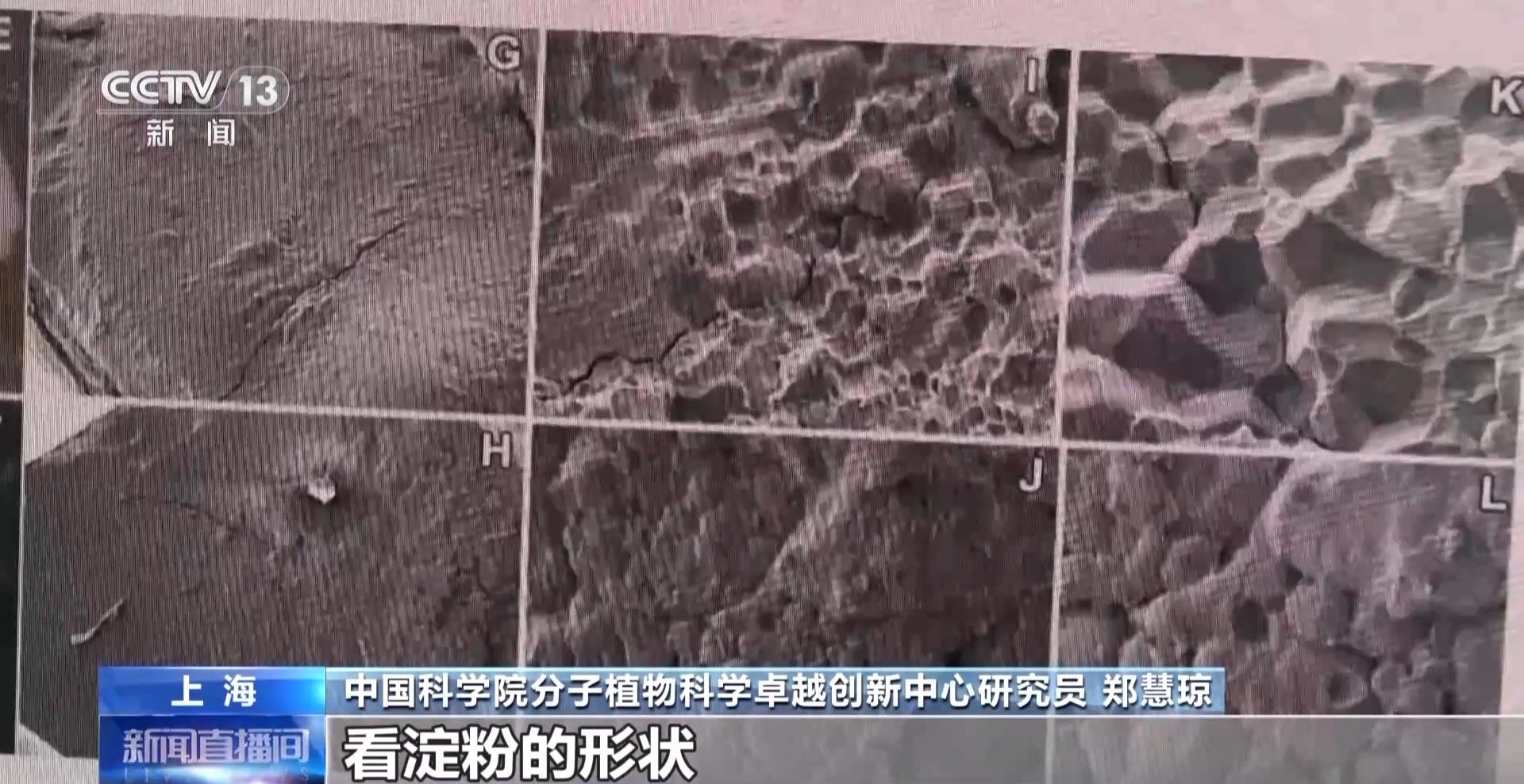 
中国中医科学院眼科医院黄牛代挂号电话票贩子号贩子网上预约挂号,住院检查加快,天上的水稻吃起来更甜？一起了解“太空水稻”和普通水稻的不同点