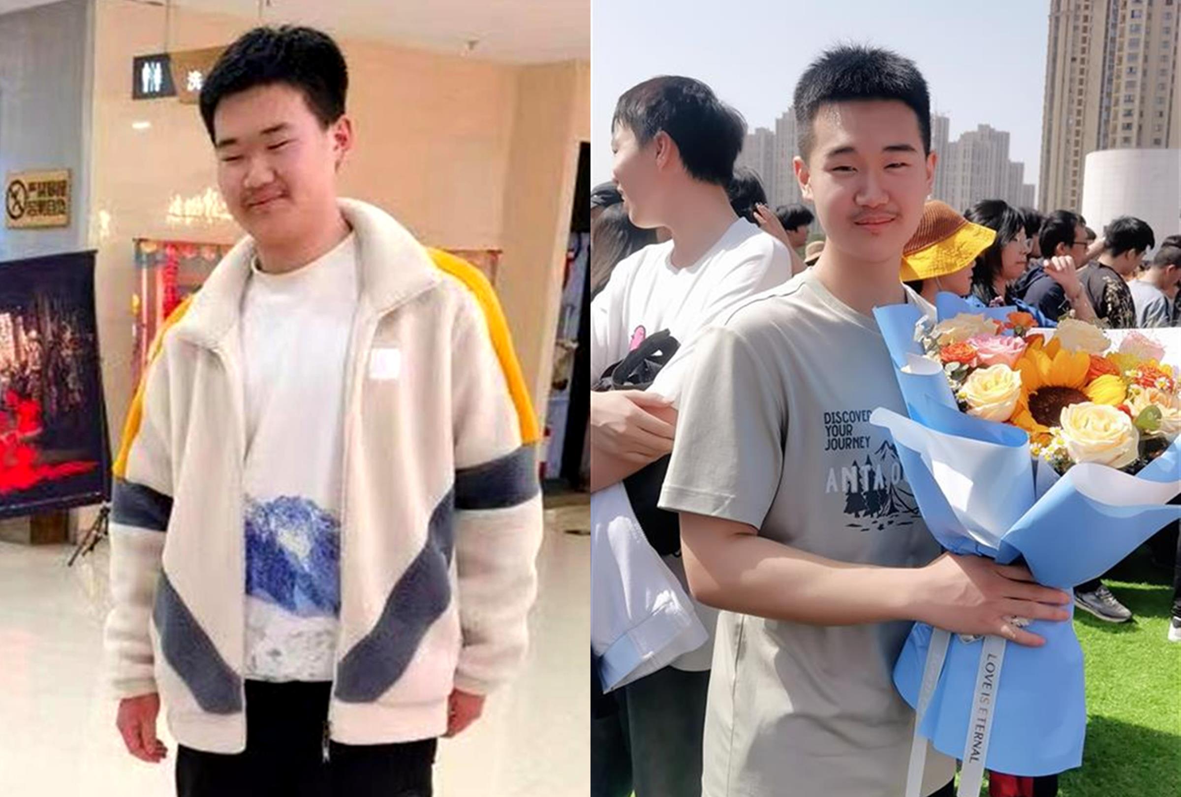 
中国人民解放军总医院黄牛代挂号电话票贩子号贩子网上预约挂号,住院检查加快,用望远镜看黑板的男孩被清华录取 为追梦人点赞！