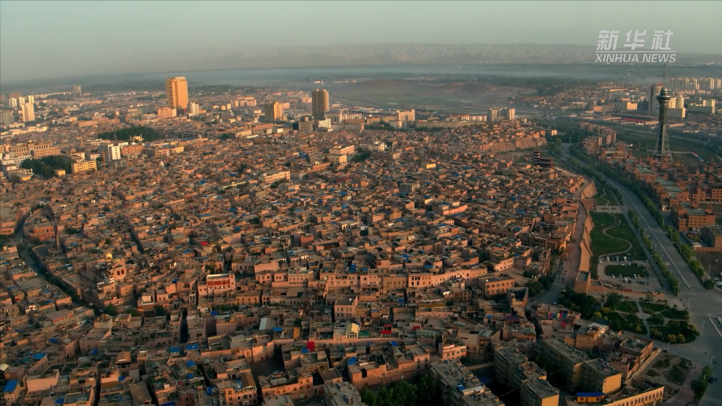 首都医科大学附宣武医院黄牛代挂号电话票贩子号贩子网上预约挂号,住院检查加快,中非合作论坛|跨越千山万水的爱 迪力与迪雅的喀什情缘