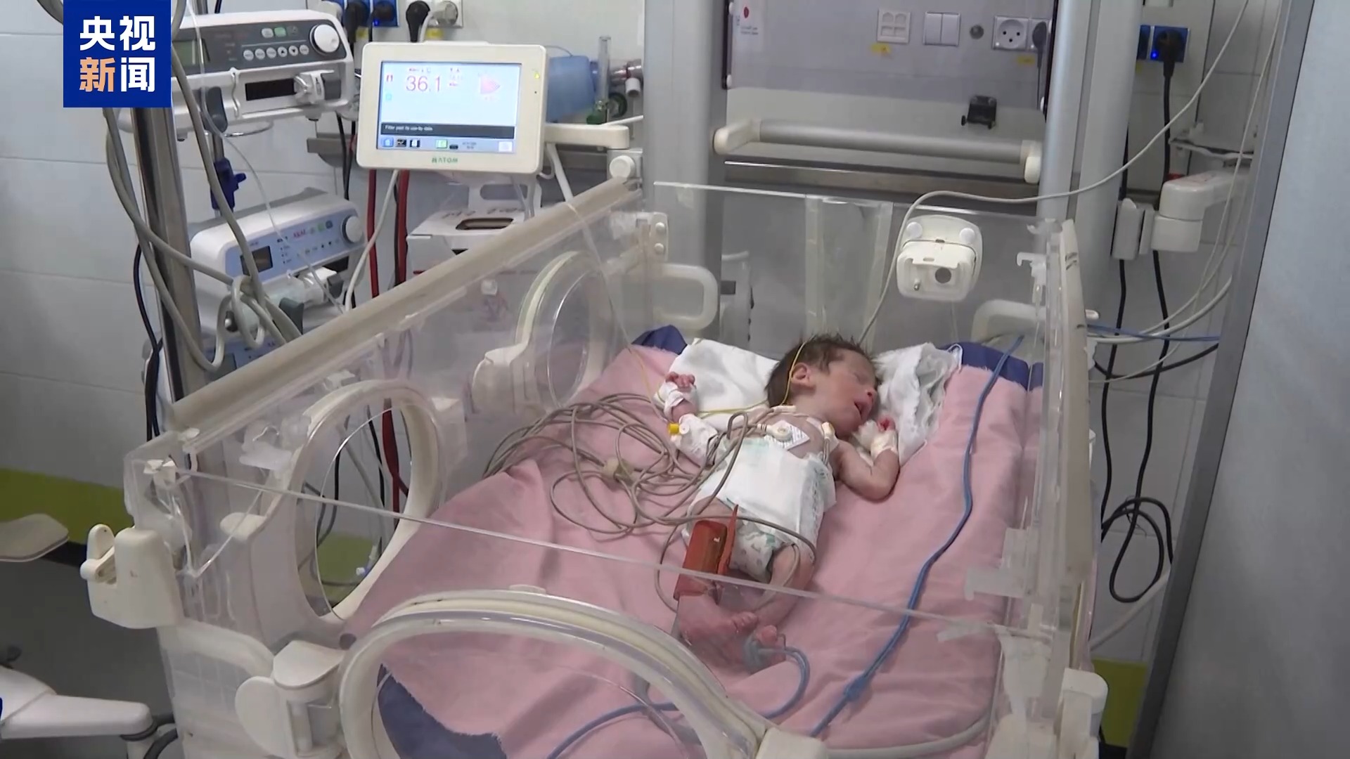 
上海肺科医院黄牛代挂号电话票贩子号贩子网上预约挂号,住院检查加快,加沙地带半月内至少6名婴儿因体温过低死亡