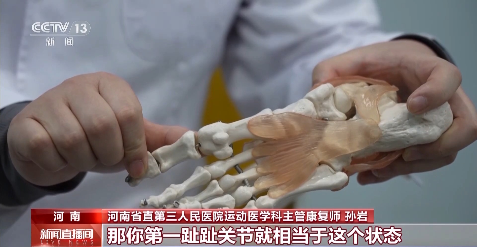 
民航总医院黄牛号贩子票贩子代网上预约代挂号电话疯狂种草碳板跑鞋？医生：足底筋膜炎警告！