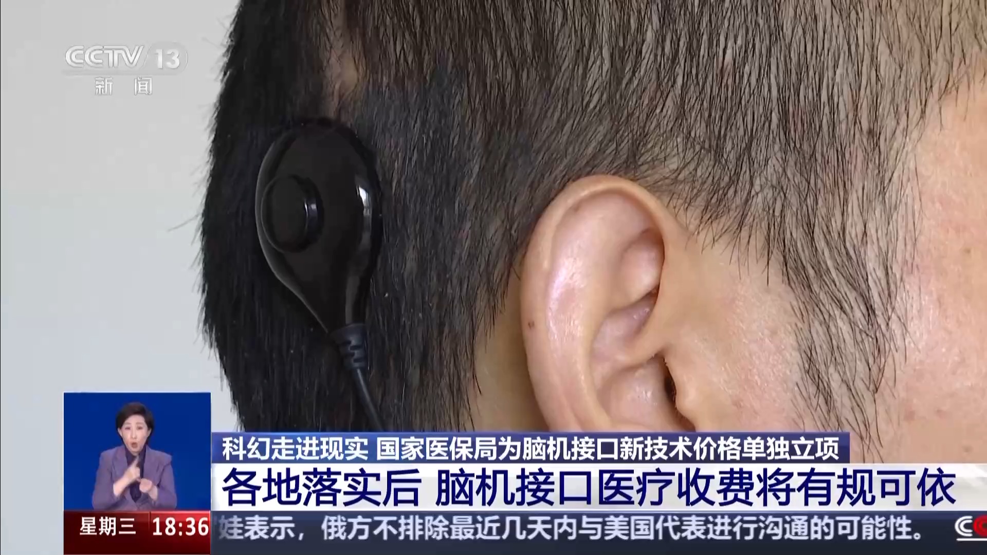 
天津肿瘤医院黄牛代挂号电话票贩子号贩子网上预约挂号,住院检查加快,一问到底丨科幻照进现实 脑机接口如何守护生命？