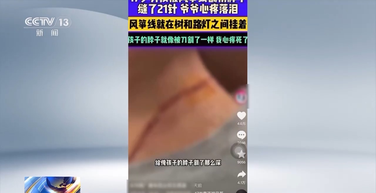 
杭州市一医院黄牛代挂号电话票贩子号贩子网上预约挂号,住院检查加快,春季出游，警惕风筝线变“夺命线”