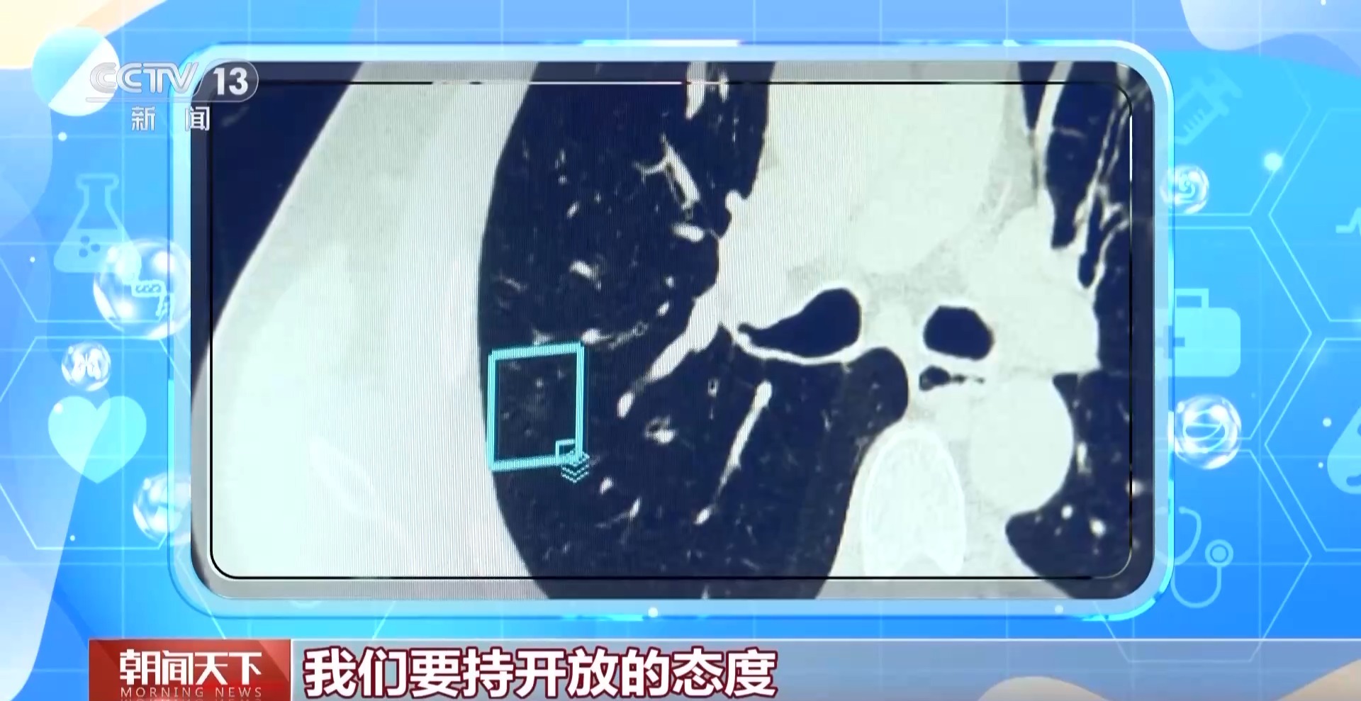 
南京儿童医院黄牛代挂号电话票贩子号贩子网上预约挂号,住院检查加快,“AI医生”能取代医生吗？听听医药科技专家学者怎么说→