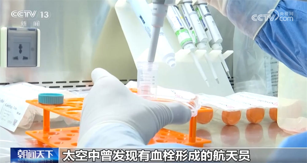 
首都医科院整形外科医院黄牛代挂号电话票贩子号贩子网上预约挂号,住院检查加快,中国空间站“上新”三项细胞学实验 一起期待揭开更多“生命密码”