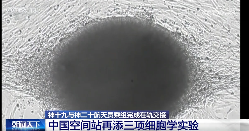 
首都医科院整形外科医院黄牛代挂号电话票贩子号贩子网上预约挂号,住院检查加快,中国空间站“上新”三项细胞学实验 一起期待揭开更多“生命密码”