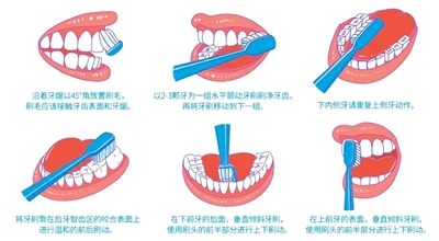 
浙江第二医院黄牛代挂号电话票贩子号贩子网上预约挂号,住院检查加快,牙周病：“难以启齿”源于长期忽视（看新闻·说健康）