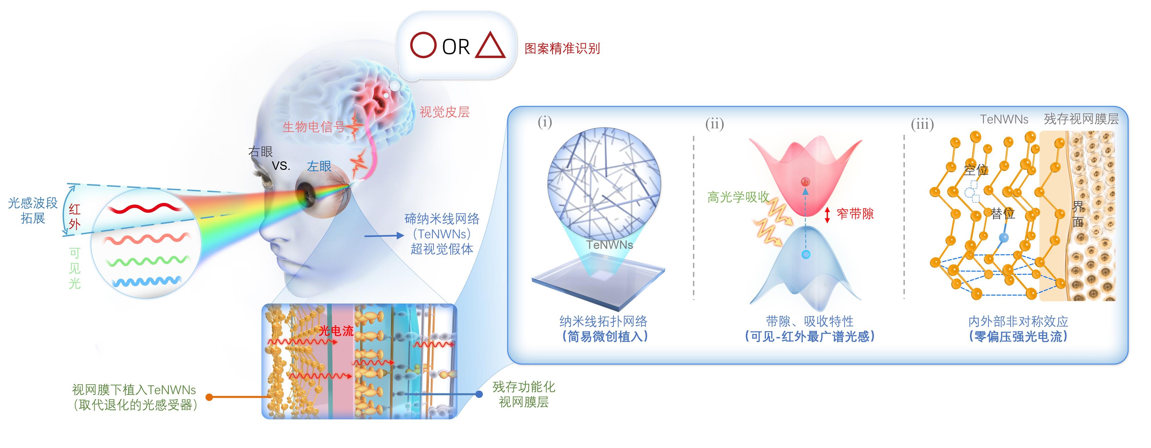 △TeNWNs修复和增强盲人视觉示意图及作用机制