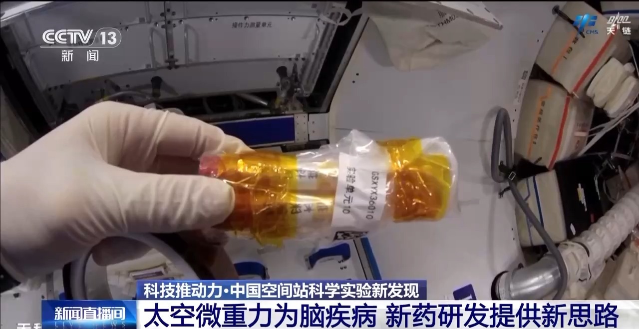 
江苏省中西医结合医院黄牛代挂号电话票贩子号贩子网上预约挂号,住院检查加快,中国空间站完成空间生命科学在轨实验任务 还刷新一项新纪录