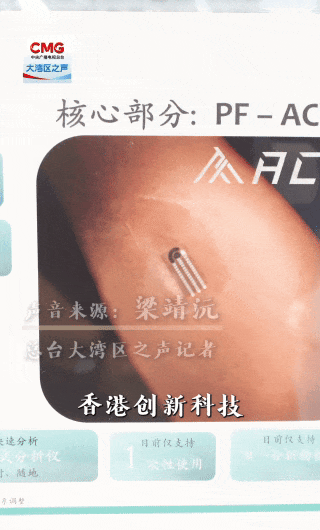 
北京西苑医院黄牛代挂号电话票贩子号贩子网上预约挂号,住院检查加快,勇立潮头大湾区丨打造“智慧全运” 香港科技“够晒醒”
