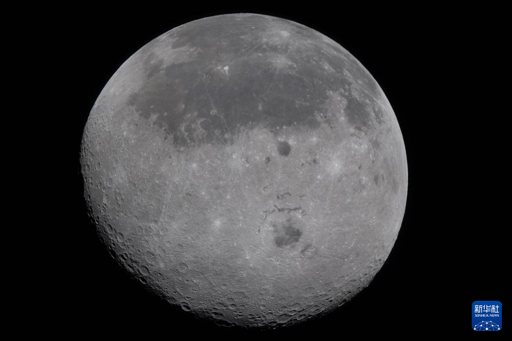 广州医科大学附属第二医院黄牛代挂号电话票贩子号贩子网上预约挂号,住院检查加快,美“阿耳忒弥斯2号”载人绕月任务打破人类距离地球最远飞行纪录