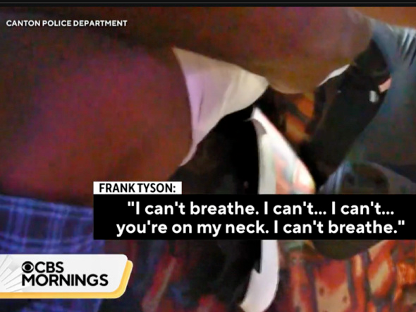 “我无法呼吸”暴露出的“美国绝症”