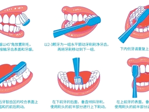 牙周病：“难以启齿”源于长期忽视（看新闻·说健康）