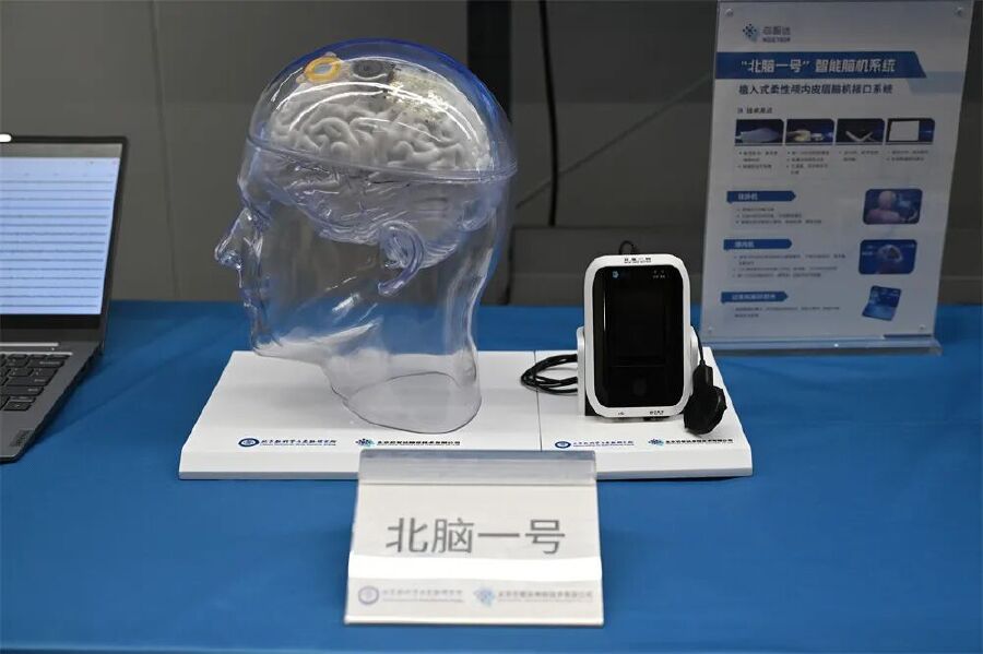 
重庆医科大学附属第二医院李小凤医生黄牛预约代挂号电话60天，跨越2200公里去追“新”丨活力中国调研行