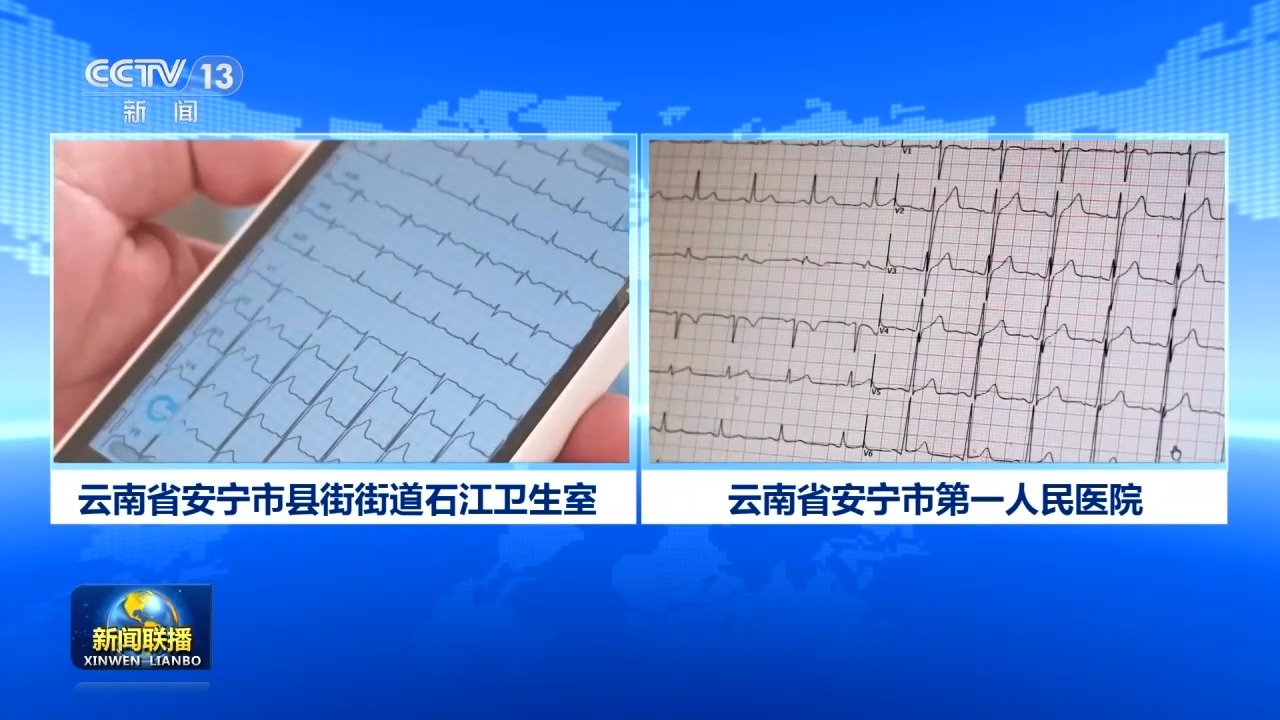 
陆军军医大学新桥医院杨鹰医生黄牛预约代挂号电话新思想引领新征程丨优质医疗资源下沉惠民 绘就健康中国新图景